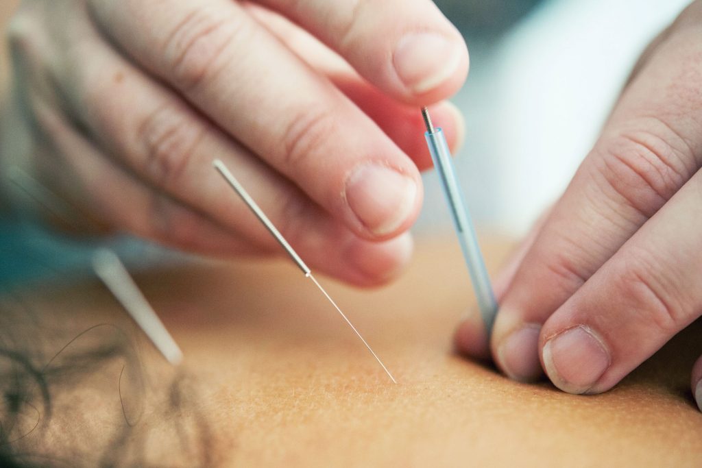 the bosy sage acupuncture